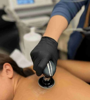 Dry Needling 2